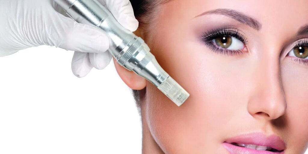 Microneedling TF 1500x750 low res scale 2 00x gigapixel