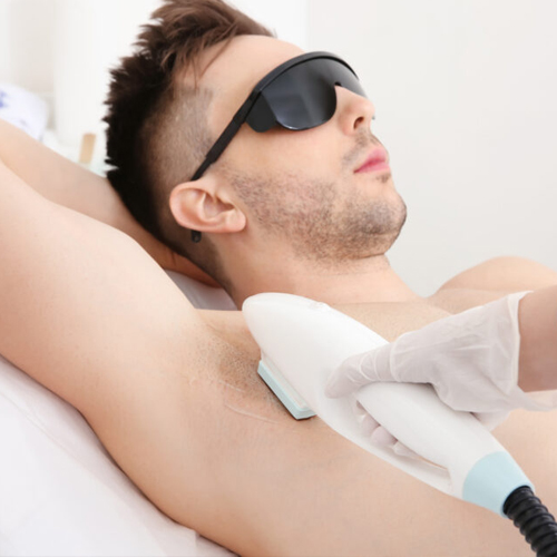 Laser Hair Removal