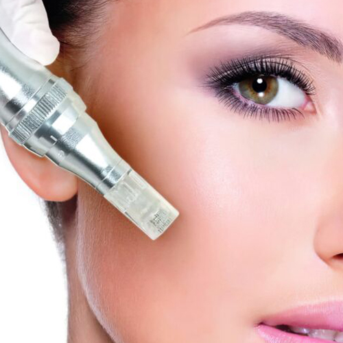 Microneedling